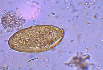 Životní cyklus hepatální trematody. Jaterní náhoda: struktura