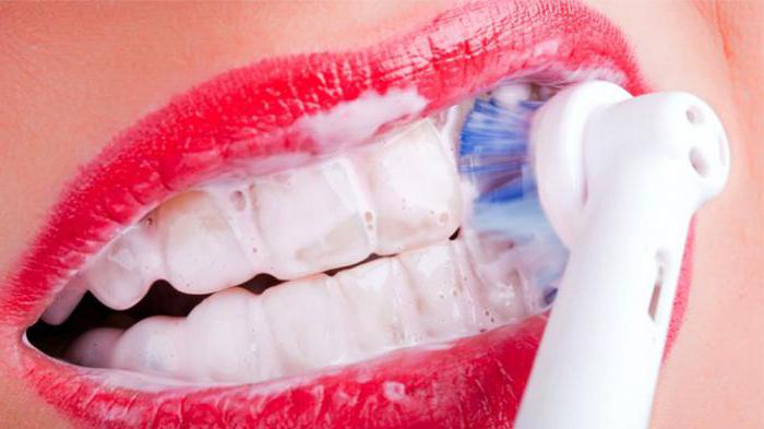 Čištění a leštění zubů