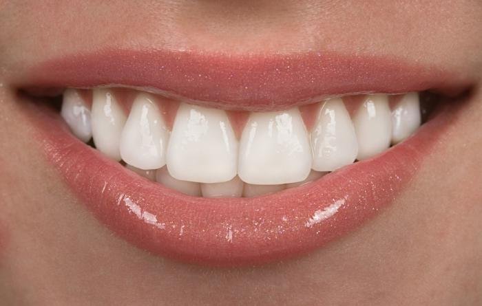 Moderní dýhy na zubech: co je to?